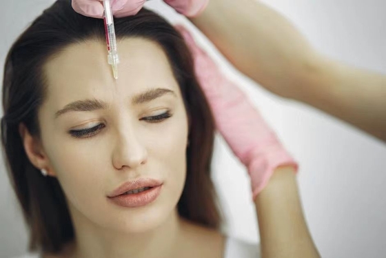 Tiêm axit hyaluronic liên kết chéo chất lấp da Natri hyaluronate Gel