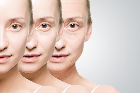Hyaluronic Acid Lip Gel Tiêm Mắt nhăn Synthetic Hyaluronic Acid Dermal Filler