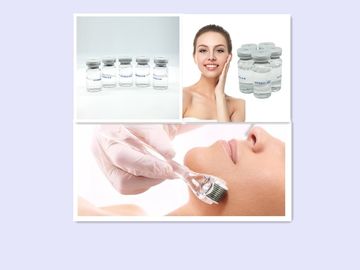 Phẫu thuật thẩm mỹ Không liên kết chéo HA Chất độn da 5ml Nếp nhăn quanh môi Phụ