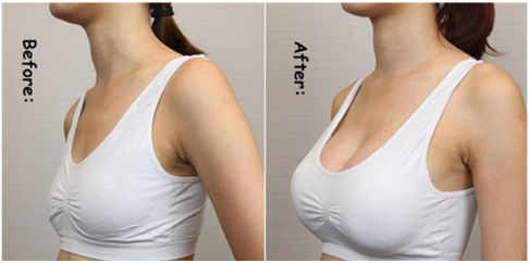 Thuốc tiêm axit hyaluronic Ha Filler cho môi Nếp nhăn mặt Nâng vú Tiêm chất tiêm mông