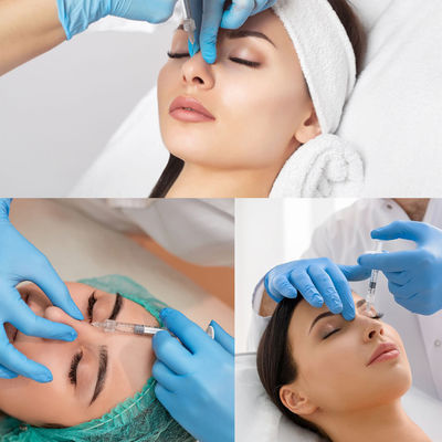 Tiêm axit hyaluronic Sodium Hyaluronate để làm đầy nếp nhăn trên khuôn mặt Chất làm đầy môi