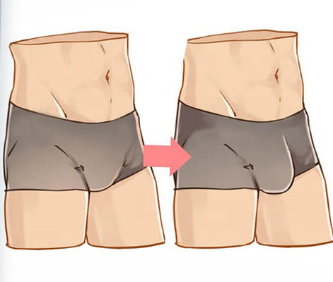 Chất làm đầy da bằng axit hyaluronic tăng cường dương vật mà không cần phẫu thuật