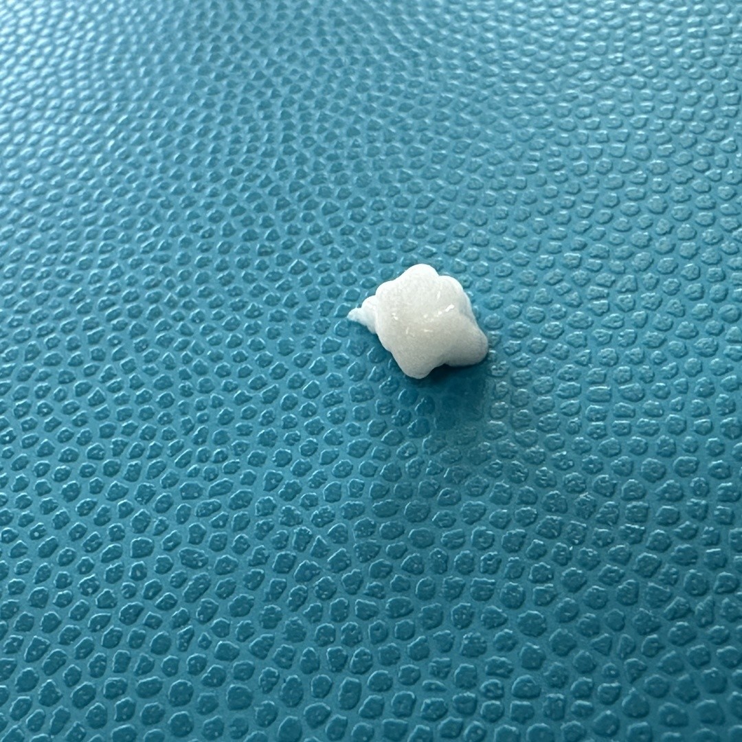 Hiệu ứng lấp đầy nâng cao trên các đường rối bằng tiêm Calcium Hydroxyapatite