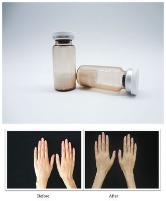 Bộ lấp da khuôn mặt vô trùng PLLA Hyaluronic Acid Injectable Gel Được thiết kế để điều chỉnh nếp nhăn mượt mà và khôi phục khối lượng khuôn mặt