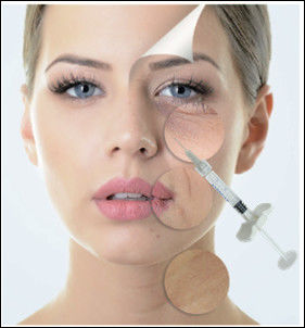 1ml 1.1ml Chất làm đầy da Hyaluronic Acid liên kết chéo cho má giữa mũi