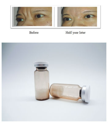 Biocompatible Injectable PLLA Filler Dermal Filler để phục hồi khối lượng khuôn mặt lâu dài và điều chỉnh nếp nhăn