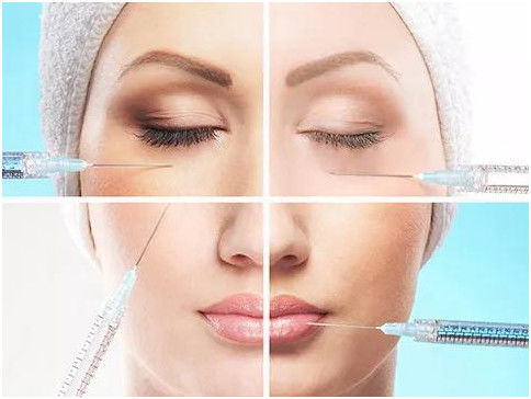 Hyaluronic Acid Gel tiêm nhăn và chất lấp nén đường mỏng cho da mịn hơn